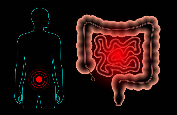 Best Inflammatory Bowel Disease Treatment in Malad