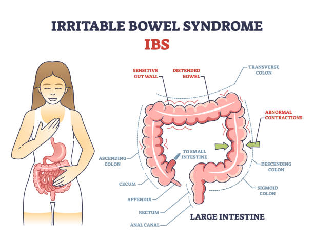 Best Irritable Bowel Syndrome Treatment in Malad